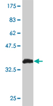 RPL19 monoclonal antibody (M01), clone 3H4