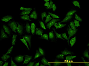 RPL19 monoclonal antibody (M01), clone 3H4