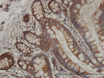 RPL19 monoclonal antibody (M01), clone 3H4