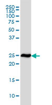 RPL19 monoclonal antibody (M01), clone 3H4