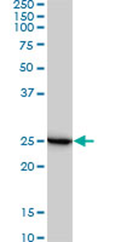 RPL19 monoclonal antibody (M01), clone 3H4