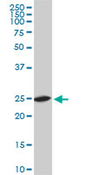 RPL19 monoclonal antibody (M01), clone 3H4