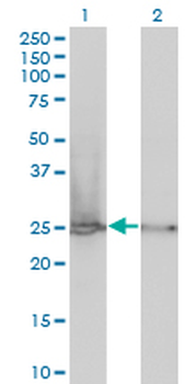 RPL19 monoclonal antibody (M01), clone 3H4