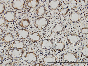 QARS monoclonal antibody (M01), clone 5F5