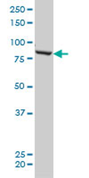 QARS monoclonal antibody (M01), clone 5F5