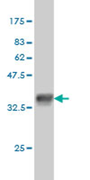 QARS monoclonal antibody (M01), clone 5F5