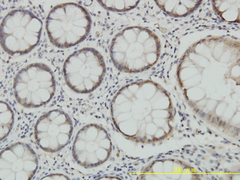 PSMA7 monoclonal antibody (M01), clone 1A10-3G12