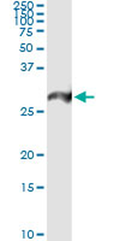 PSMA7 monoclonal antibody (M01), clone 1A10-3G12