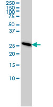 PSMA7 monoclonal antibody (M01), clone 1A10-3G12