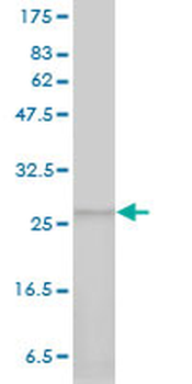 PSMA7 monoclonal antibody (M01), clone 1A10-3G12