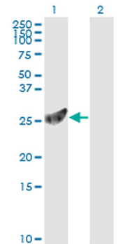 PSMA7 monoclonal antibody (M01), clone 1A10-3G12