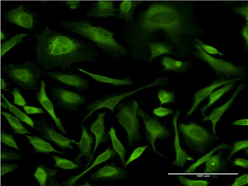 MAPK8 monoclonal antibody (M11), clone 2F11