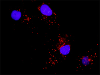 MAPK8 monoclonal antibody (M11), clone 2F11