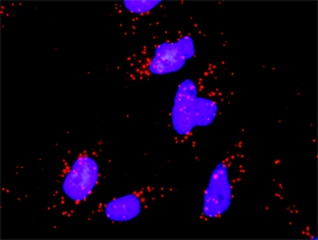 MAPK8 monoclonal antibody (M11), clone 2F11