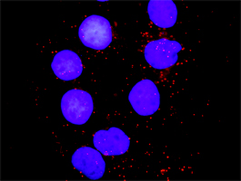 MAPK8 monoclonal antibody (M11), clone 2F11