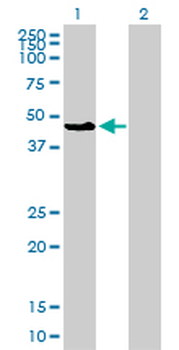 MAPK8 monoclonal antibody (M11), clone 2F11