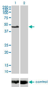 MAPK8 monoclonal antibody (M11), clone 2F11