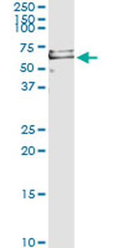 PRF1 monoclonal antibody (M04), clone 3B4