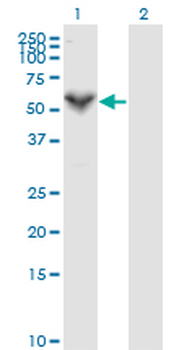 PRF1 monoclonal antibody (M04), clone 3B4