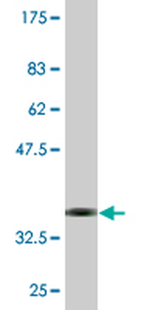 PRF1 monoclonal antibody (M04), clone 3B4