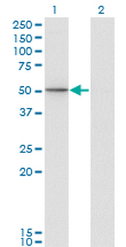 PIK3R1 monoclonal antibody (M01), clone 3A10