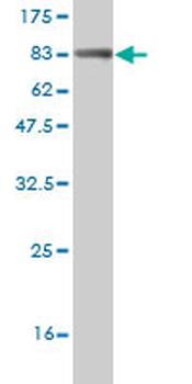 PIK3R1 monoclonal antibody (M01), clone 3A10