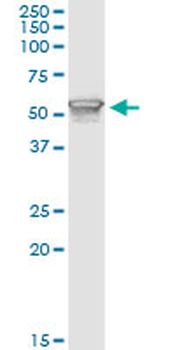 PIK3R1 monoclonal antibody (M01), clone 3A10