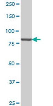 PIK3R1 monoclonal antibody (M01), clone 3A10