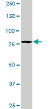 PIK3R1 monoclonal antibody (M01), clone 3A10