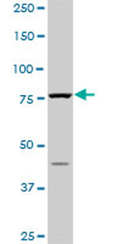 PIK3R1 monoclonal antibody (M01), clone 3A10