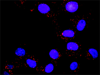 PIK3R1 monoclonal antibody (M01), clone 3A10