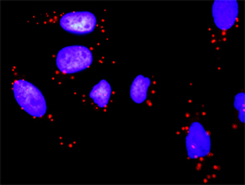 PIK3R1 monoclonal antibody (M01), clone 3A10