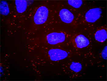 PIK3R1 monoclonal antibody (M01), clone 3A10