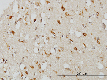 SERPINI1 monoclonal antibody (M01), clone 1D10