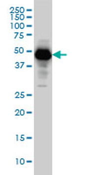 SERPINI1 monoclonal antibody (M01), clone 1D10