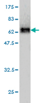 SERPINI1 monoclonal antibody (M01), clone 1D10