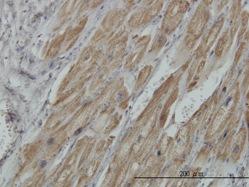 PDHB monoclonal antibody (M03), clone 2B2