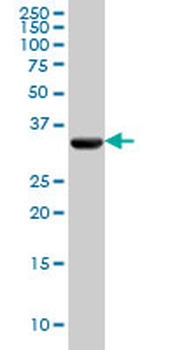 PDHB monoclonal antibody (M03), clone 2B2