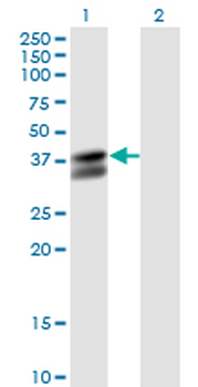 PDHB monoclonal antibody (M03), clone 2B2