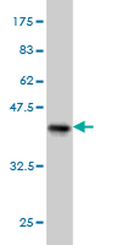 PDHB monoclonal antibody (M03), clone 2B2