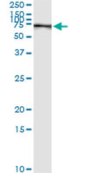 PCK1 monoclonal antibody (M01), clone 3E4