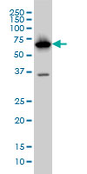 PCK1 monoclonal antibody (M01), clone 3E4