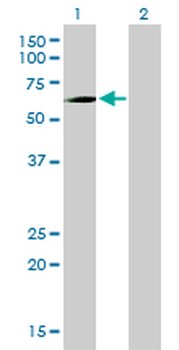 PCK1 monoclonal antibody (M01), clone 3E4