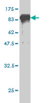 PCK1 monoclonal antibody (M01), clone 3E4