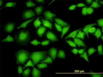 NME1 monoclonal antibody (M02), clone 1D7