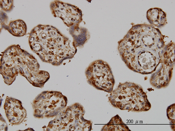 NME1 monoclonal antibody (M02), clone 1D7