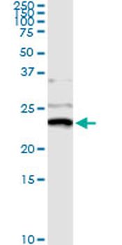 NME1 monoclonal antibody (M02), clone 1D7