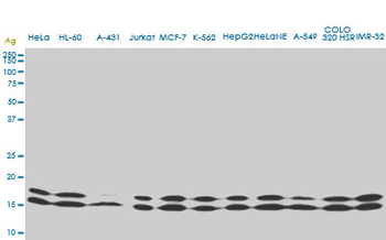 NME1 monoclonal antibody (M02), clone 1D7