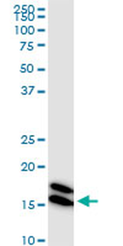 NME1 monoclonal antibody (M02), clone 1D7