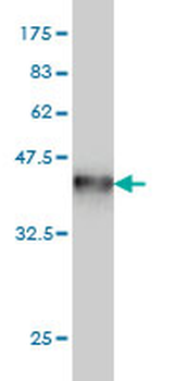 NME1 monoclonal antibody (M02), clone 1D7